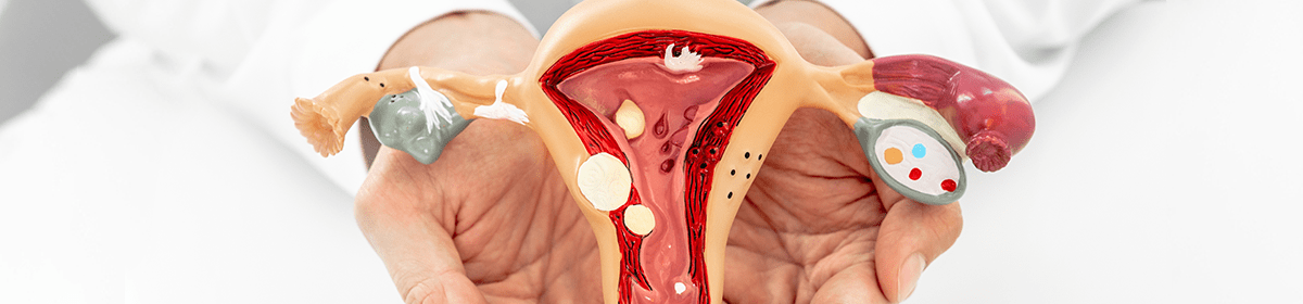 Adenomyosis can be Responsible for Heavy Vaginal Bleeding and Pain During a  Menstruation Cycle, Best Uro-Gynecologist Los Angeles, OB/GYN Glendale